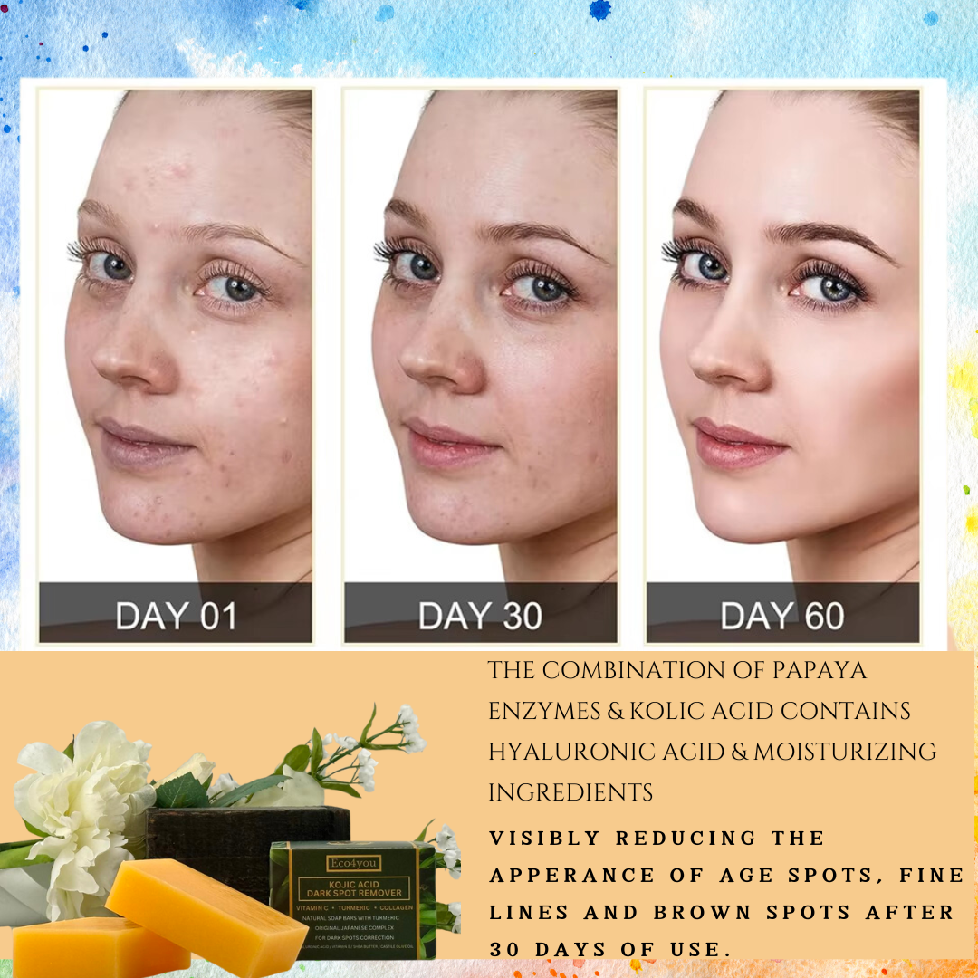 Eco4you Kojic Acid Soap for Dark Spots – Enhanced with Turmeric, Vitamin C, Retinol, and Collagen – Japanese-Inspired Formula with Hyaluronic Acid, Vitamin E, Shea Butter, and Castile Olive Oil (2 Pack)